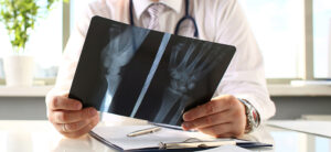 Medico traumatólogo mirando una radiografia de huesos en consulta