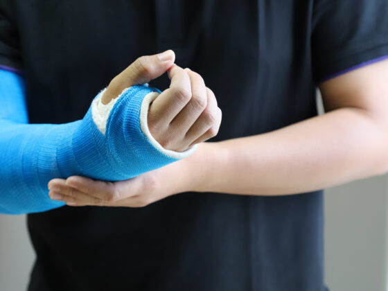 accidente de trafico mano rota